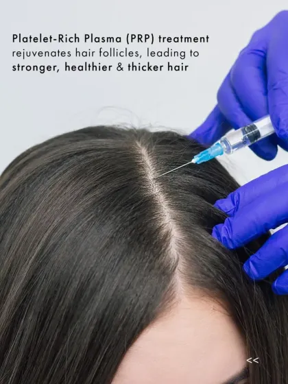 For women experiencing hair thinning or a widening parting, PRP treatment offers a targeted solution. I perform precise injections of platelet-rich plasma into the scalp to rejuvenate follicles, improve hair strength, and promote new, healthy growth.