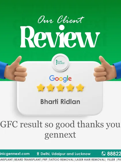 A happy patient review highlighting the good results from our GFC (Growth Factor Concentrate) treatment. We are thankful for the trust our patients place in us.