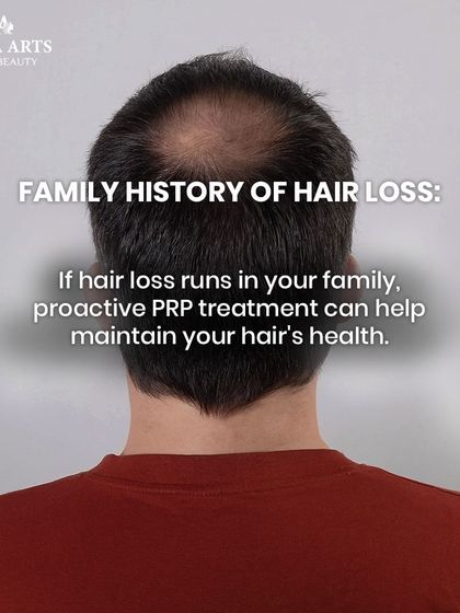 Sign: Family history of hair loss. If baldness runs in your family, proactive PRP treatments can be a great way to maintain your hair's health and delay the onset of genetic hair loss.