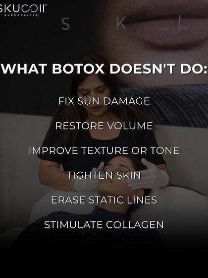 It is important to understand what Botox does not do. It cannot fix sun damage, restore lost volume, or tighten sagging skin. For these concerns, I recommend other treatments as part of my Full Face Protocol.