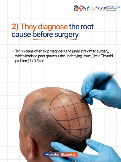 A proper diagnosis is the first and most important step. Technicians often skip this and jump to surgery, which can lead to poor growth if an underlying issue like a thyroid problem isn't addressed first. I always perform a detailed scalp analysis.