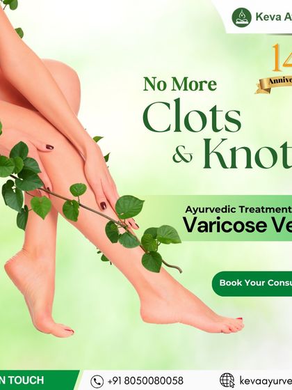 No more clots and knots. We provide effective Ayurvedic treatment for varicose veins to restore healthy circulation, reduce pain, and rejuvenate your legs naturally.