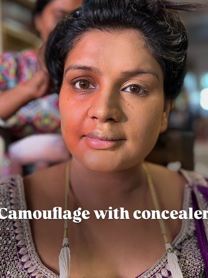 The second step: camouflage. After color correcting, I use a concealer that matches her skin tone to completely cover any discoloration.