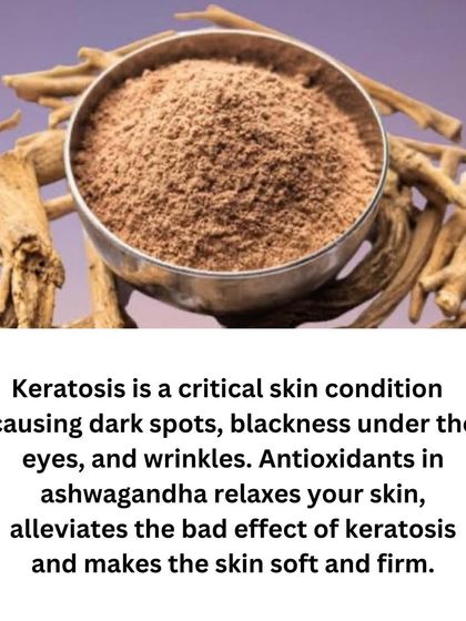 Keratosis can cause dark spots and wrinkles. The antioxidants in Ashwagandha, a key ingredient in my under-eye oil, help relax your skin and make it soft and firm.