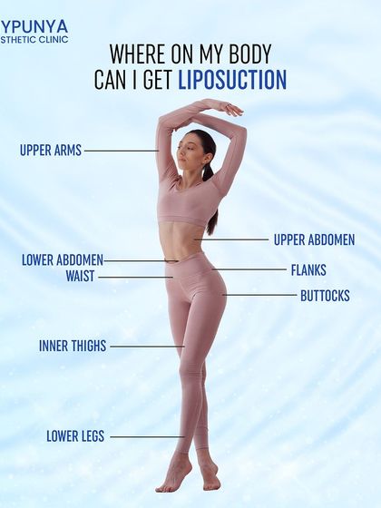 Liposuction can be used to target localized fat on the upper arms, upper and lower abdomen, waist, flanks, buttocks, inner thighs, and lower legs.