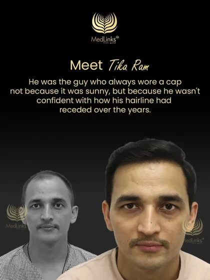 This collage tells the story of Tika Ram, who used to wear a cap to hide his receded hairline but now walks with confidence.
