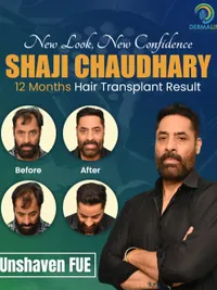 Hair Transplant & Restoration