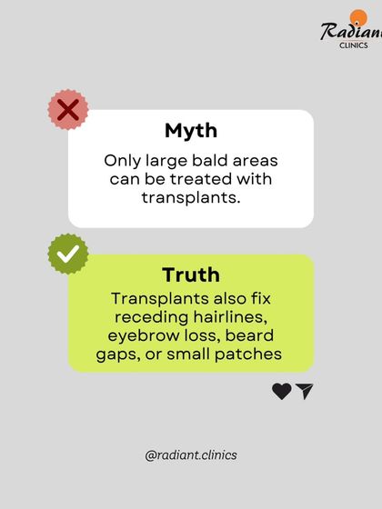 Hair transplants are not just for large bald areas. The FUE technique is precise enough to fix receding hairlines, fill in beard gaps, restore eyebrows, or target small patches of hair loss with great accuracy.