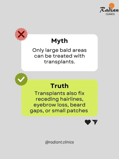 Myth: Transplants are only for large bald areas. Truth: I perform transplants for many needs, including fixing receding hairlines, filling gaps in beards or eyebrows, and covering small patches.