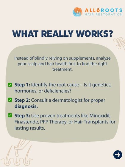 So what really works? Instead of blindly relying on supplements, the first step is to identify the root cause with a proper diagnosis from a dermatologist. Proven treatments like Minoxidil, Finasteride, PRP Therapy, or Hair Transplants deliver lasting results.