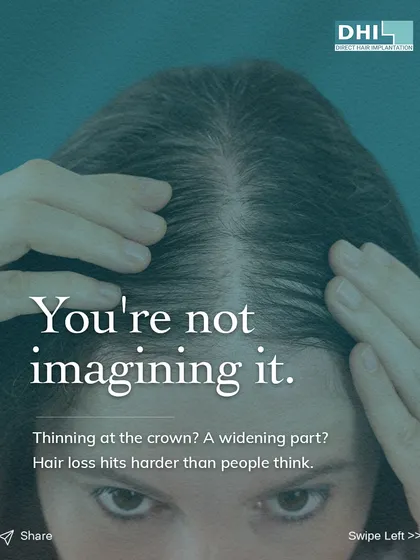 **You're Not Imagining It, and You're Not Alone:** We understand that a widening part or thinning at the crown is a real and personal concern. This image acknowledges the emotional impact of hair loss and reassures you that effective, expert-led solutions are available.