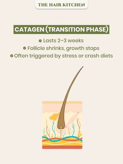 The Catagen or 'Transition' phase is a short period where the hair follicle shrinks and growth stops. As this diagram shows, this phase is often triggered by internal factors like stress or crash diets, highlighting the link between lifestyle and hair health.