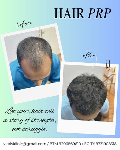 Hair Restoration & Treatment