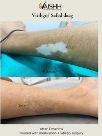 Medical & Surgical Dermatology