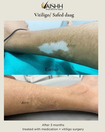Medical & Surgical Dermatology