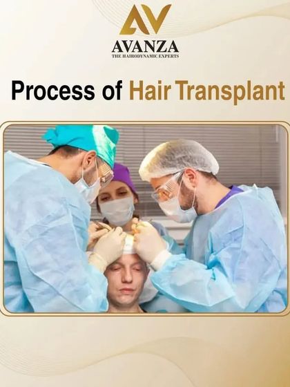 The entire hair transplant process is a surgical procedure performed by our team of expert doctors in a sterile, professional environment to ensure the best and safest outcomes.