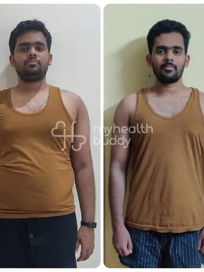 Gowtham's transformation, losing 20 kgs in 6 months, shows what's possible when you trust the process. We focused on building physical strength and changing his mindset, all while enjoying foods like biryani in moderation.