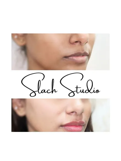 Achieve that coveted "glass skin" look with my Korean Skin Treatment. This before-and-after shows how the treatment evens out skin tone, reduces pigmentation, and imparts a luminous, healthy glow. It’s a fantastic way to get radiant skin without layers of makeup.