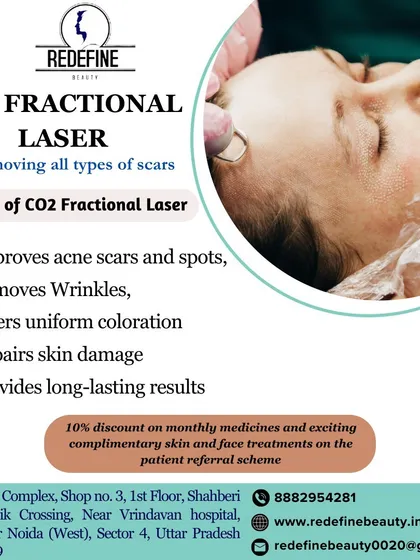 This graphic explains the benefits of the CO2 Fractional Laser for removing all types of scars. It improves acne scars, removes wrinkles, and repairs skin damage for uniform coloration and long-lasting results.