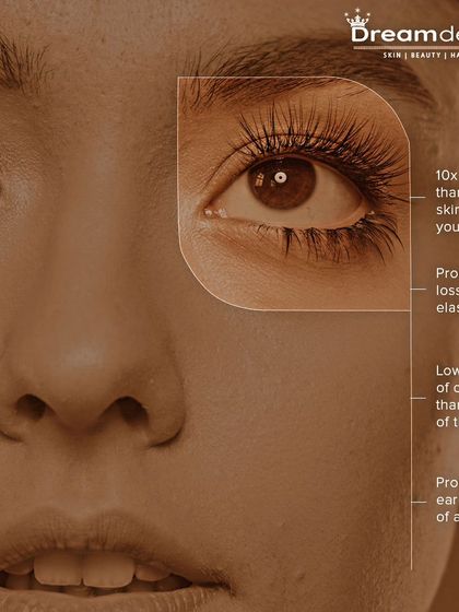 An educational graphic explaining why the delicate under-eye area is prone to early signs of aging due to thinner skin and lower collagen levels.