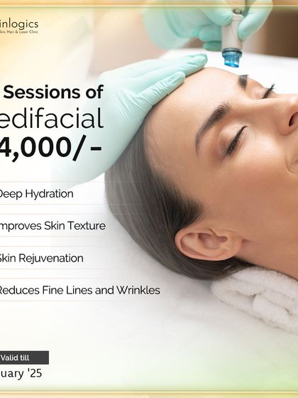 This Republic Day, get deep hydration and improved skin texture with our 2+2 sessions of Medifacial package. It's a perfect way to rejuvenate your skin and reduce fine lines.