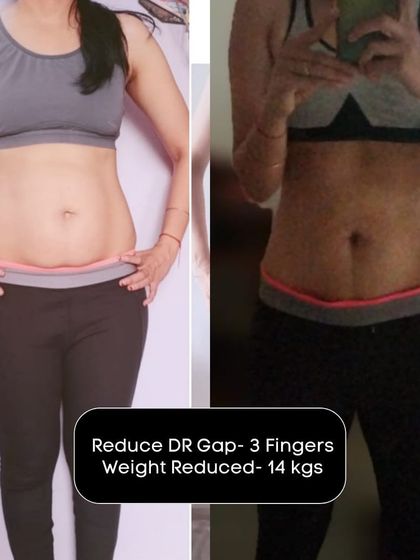 A duplicate of 237, emphasizing the incredible 14kg weight loss and 3-finger DR gap reduction.