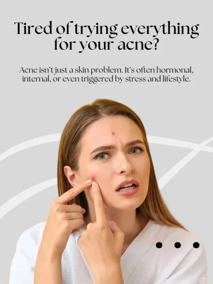This graphic addresses the frustration of dealing with persistent acne. It highlights that acne is often an internal issue, which is why our approach involves a thorough diagnosis to find the true trigger.