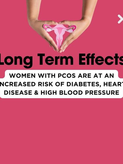 Fact: PCOS can have long-term health effects, increasing the risk of diabetes, heart disease, and high blood pressure. Proactive management is key to mitigating these risks.