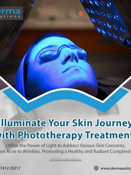 This is a look at a phototherapy session in progress. The patient is comfortably positioned while a specific wavelength of blue light is administered to the skin. We use protective eyewear to ensure complete safety during this precise, dermatologist-supervised treatment for conditions like acne.