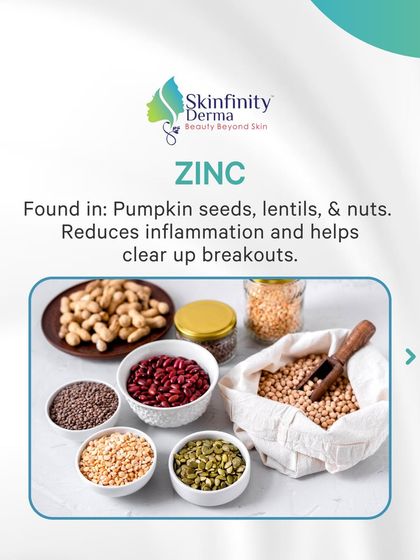 Zinc, found in pumpkin seeds and nuts, is great for reducing inflammation and helping to clear up breakouts. It's an important mineral for maintaining clear skin.