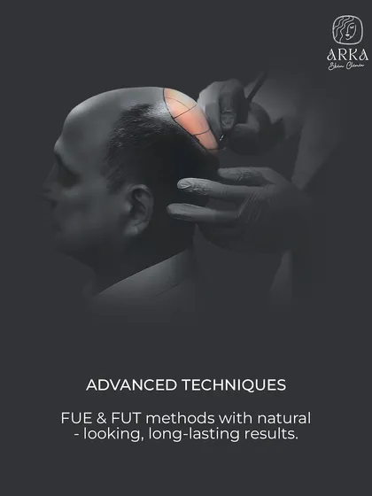 We specialize in advanced FUE and FUT hair transplant methods. Our focus is on creating long-lasting, natural-looking results by carefully planning the placement and angle of each hair follicle.