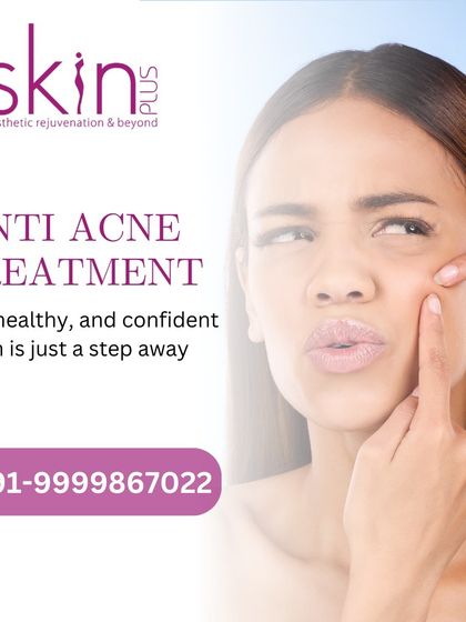 Acne, Pores & Scar Correction photo 18