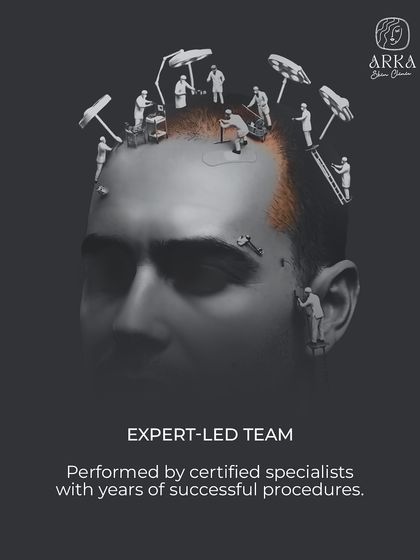 Your procedure is performed by an expert-led team of certified specialists with years of experience. This image illustrates the precision and teamwork that goes into every successful hair transplant we perform.