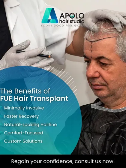 We specialize in the FUE hair transplant technique. This graphic explains its key benefits: it is a minimally invasive procedure that allows for faster recovery and results in a natural looking hairline, all tailored to your specific needs.