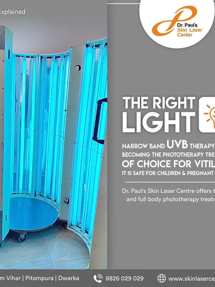 This is our full-body Narrowband UVB phototherapy unit. It is considered a gold standard in vitiligo care, delivering targeted light to treat widespread patches. This therapy is safe and effective for both adults and children.