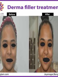 Facial Anti-Aging & Rejuvenation