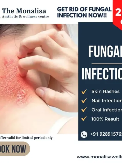 We offer effective medical treatments for fungal infections affecting the skin and nails. Our approach ensures you get a proper diagnosis and a plan that delivers results.