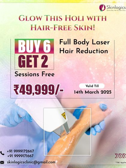 Get ready for Holi with hair-free skin. This offer includes two free sessions when you buy a package of six for full-body laser hair reduction, ensuring you are smooth and confident for the festivities.
