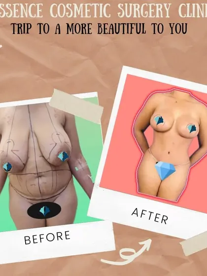 A stylized before and after graphic summarizing the goal of our cosmetic surgery clinic: a trip to a more beautiful you. It shows a complete body transformation, representing the powerful results of a Mommy Makeover.