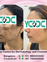 Aesthetic Dermatology