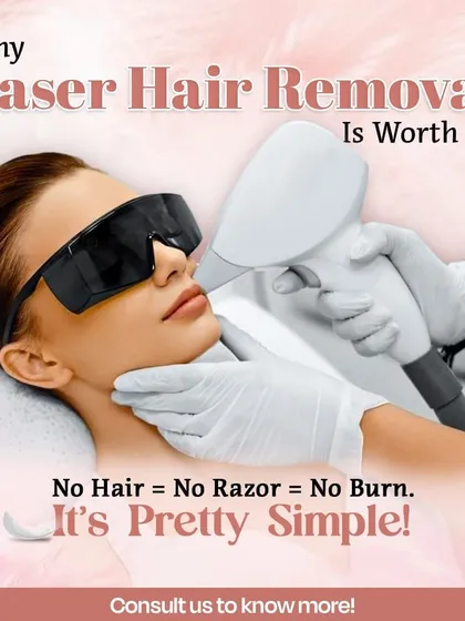 If you are tired of razor burns, nicks, and the daily hassle of shaving, laser hair removal is the perfect solution. The principle is simple: no hair means no need for a razor, which means no more irritation. It is a straightforward path to consistently smooth skin.