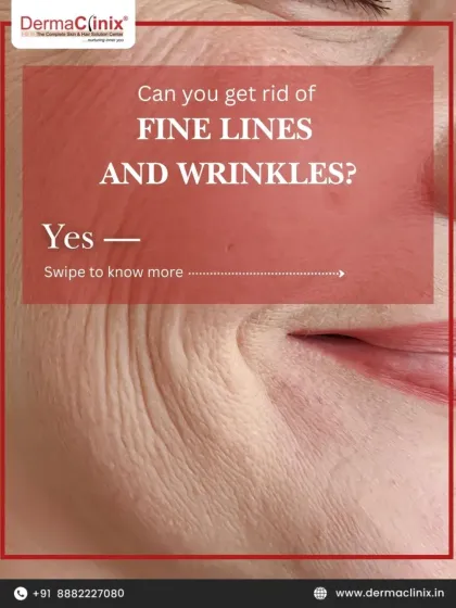 An infographic asking if you can get rid of fine lines and wrinkles. The answer is yes, with our range of treatments designed to address every type of line.