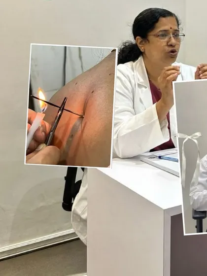A collage showing our doctors in consultation and performing Agnikarma. These are the moments of focus and expertise that define our work.