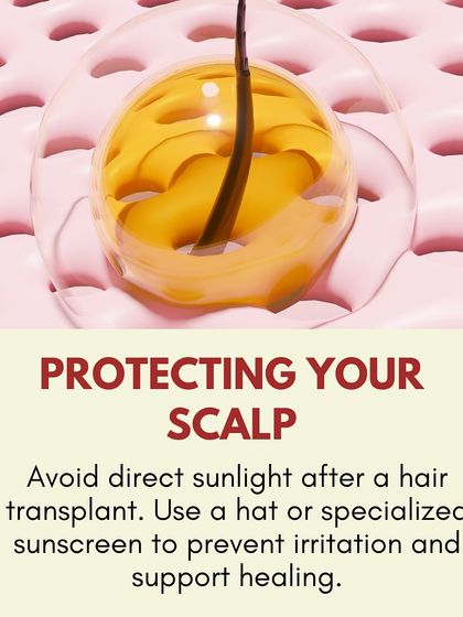 Post-procedure care: Protect your scalp from direct sunlight after a hair transplant. Use a hat or specialized sunscreen to prevent irritation and support healing.