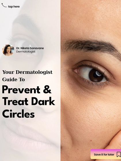 This is my dermatologist's guide to preventing and treating dark circles. From lifestyle changes to targeted treatments, understanding the cause is the first step to achieving brighter, healthier-looking eyes.