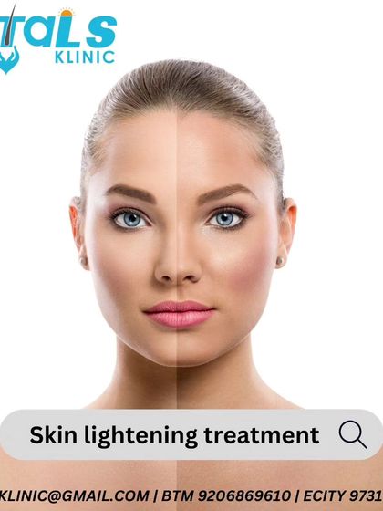 Vitals Klinic - Aesthetic Dermatology Pigmentation & Skin Tone Correction photo 6