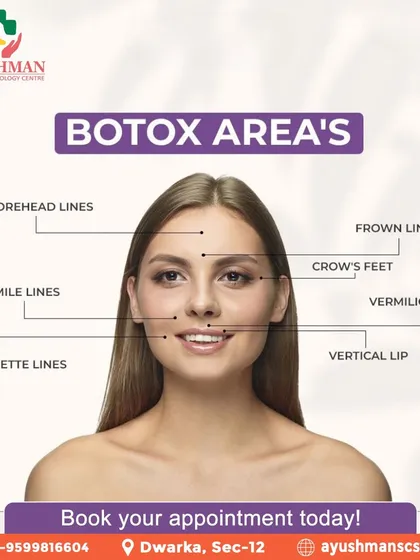 This diagram shows the common areas we treat with Botox. From forehead lines and crow's feet to smile lines, we use precise techniques to achieve a smoother, more refreshed look while maintaining natural expression.