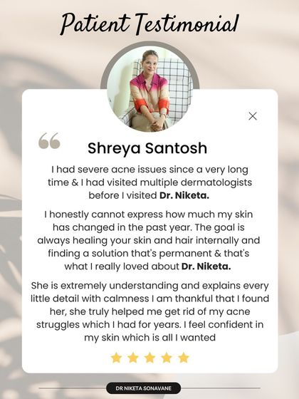 This patient came to me after visiting multiple dermatologists for severe acne. Her words about how her skin and hair have changed by focusing on internal healing is the essence of my practice. I am so thankful I could help her feel confident in her skin again.