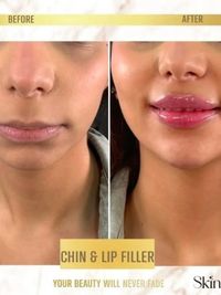 Injectables & Anti-Ageing Treatments