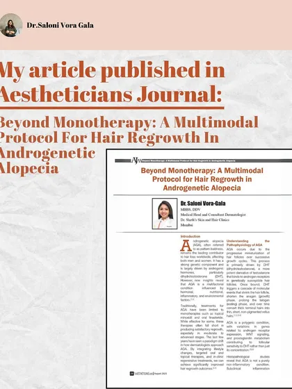 I am passionate about sharing evidence-based knowledge. I was excited to have my article on a multimodal protocol for hair regrowth in Androgenetic Alopecia published in the Aestheticians Journal. My approach goes beyond single treatments to create a comprehensive, result-driven plan for hair loss.